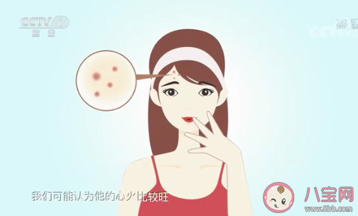 為什么成年后還會長痘痘 怎樣防止長痘痘 為什么成年后還會長痘痘 怎樣防止長痘痘