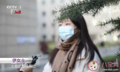 為什么成年后還會長痘痘 怎樣防止長痘痘 為什么成年后還會長痘痘 怎樣防止長痘痘