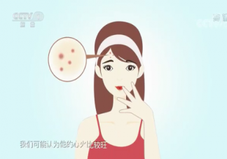 為什么成年后還會長痘痘 怎樣防止長痘痘