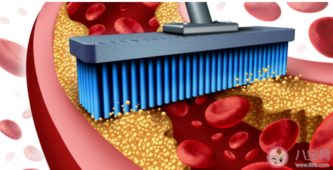讓血管變堵的5大罪魁禍首 血管堵塞會帶來什么影響 讓血管變堵的5大罪魁禍首 血管堵塞會帶來什么影響