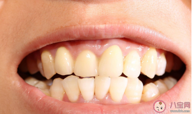 塞在牙縫里的肉絲最后會去哪兒 生活中該如何清理牙縫 塞在牙縫里的肉絲最后會去哪兒 生活中該如何清理牙縫