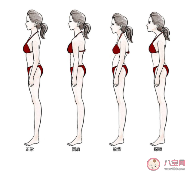 為什么現在越來越多人圓肩駝背 圓肩駝背怎么拯救頸椎 為什么現在越來越多人圓肩駝背 圓肩駝背怎么拯救頸椎