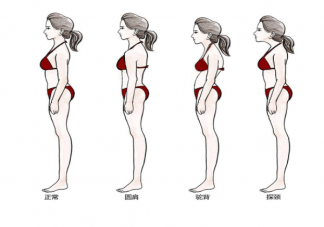 為什么現在越來越多人圓肩駝背 圓肩駝背怎么拯救頸椎