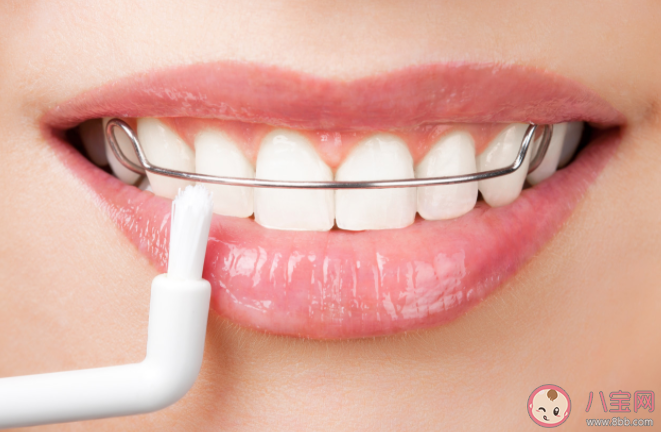 免費矯正牙齒有哪些坑 牙齒矯正要花多少錢