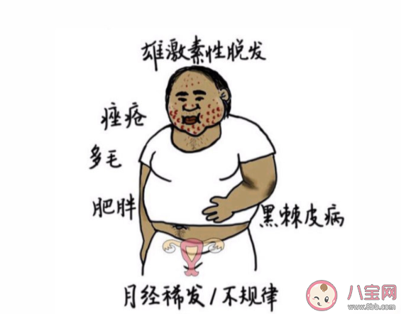 多囊卵巢綜合癥有多隱蔽 該如何應對多囊卵巢綜合癥