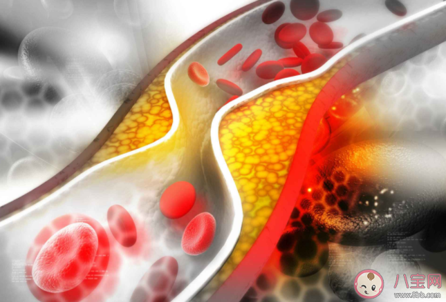 血管能不能軟化 這些軟化血管的說法都是假的
