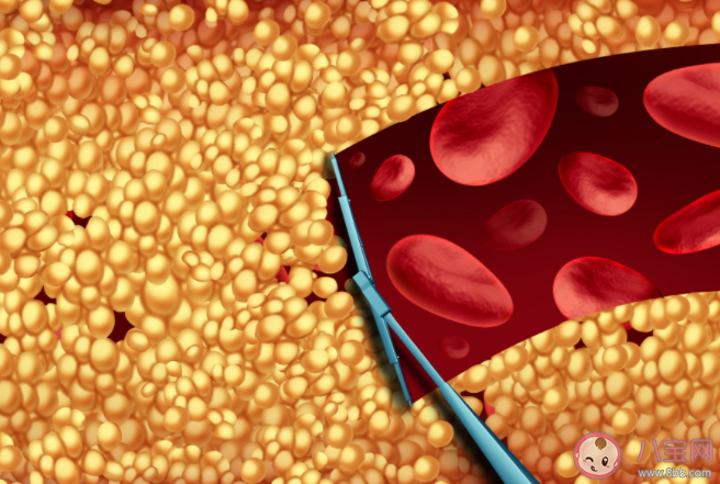 膽固醇與甘油三酯哪個升高更危險 低密度脂蛋白膽固醇的正常范圍是多少