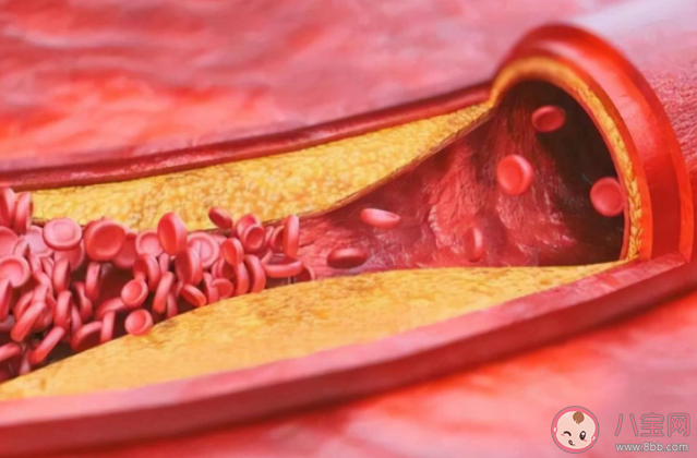 膽固醇與甘油三酯哪個升高更危險 低密度脂蛋白膽固醇的正常范圍是多少