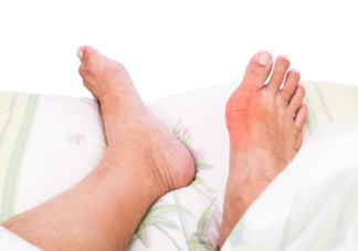 痛風(fēng)到底有多痛 如何預(yù)防痛風(fēng)