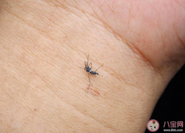 真的有招蚊體質嗎 招蚊體質有什么特征