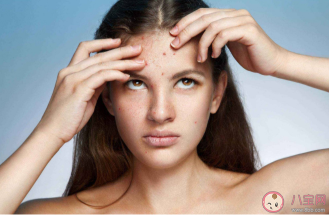 青春痘和青春有關系嗎 長青春痘怎么做好得快