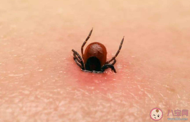 在身上發現了蜱蟲該怎么處理 蜱蟲叮咬預防建議