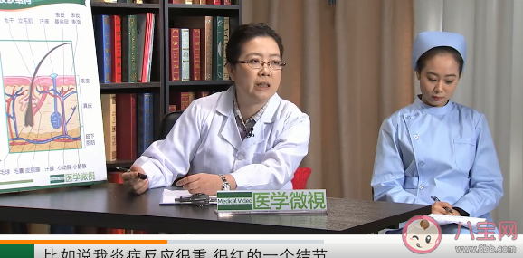 面部危險三角區的痘痘為什么不能擠 粉刺和痘痘到底能不能擠