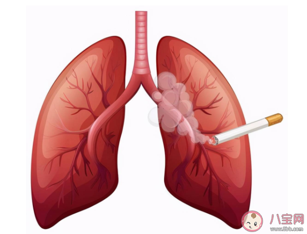 為什么不抽煙也可能得肺癌 肺癌如何預防 為什么不抽煙也可能得肺癌 肺癌如何預防