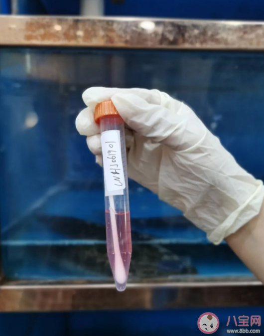 核酸檢測采樣棉簽有熒光劑嗎 采樣棉簽和普通棉簽有什么區別