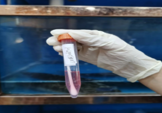 核酸檢測采樣棉簽有熒光劑嗎 采樣棉簽和普通棉簽有什么區(qū)別