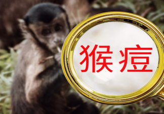 猴痘病毒可通過飛沫傳播嗎 猴痘病毒來源是什么