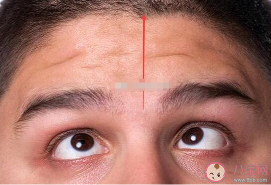 印堂發黑是迷信還是科學 怎么觀察面相發現健康問題