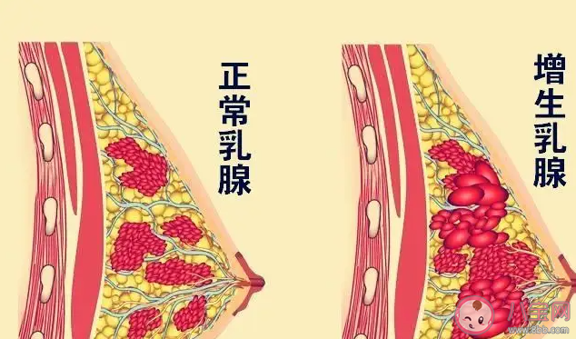 哪些行為會(huì)增加患乳腺結(jié)節(jié)的風(fēng)險(xiǎn) 患乳腺結(jié)節(jié)后會(huì)有哪些癥狀