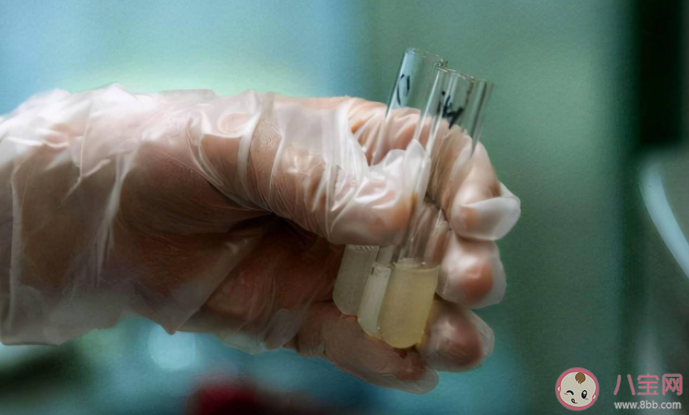 捐精要什么條件會(huì)有補(bǔ)貼嗎 捐精的好處有什么