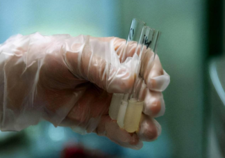 捐精要什么條件會有補貼嗎 捐精的好處有什么