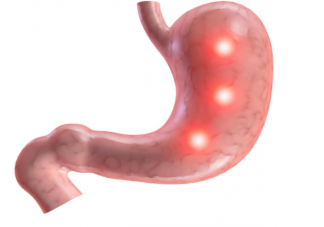 胃癌容易纏上哪種血型的人 為什么A型血容易得胃癌