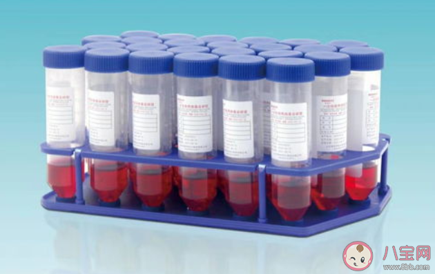 核酸檢測管里的紅色液體是什么 為什么是紅色的 核酸檢測管里的紅色液體是什么 為什么是紅色的