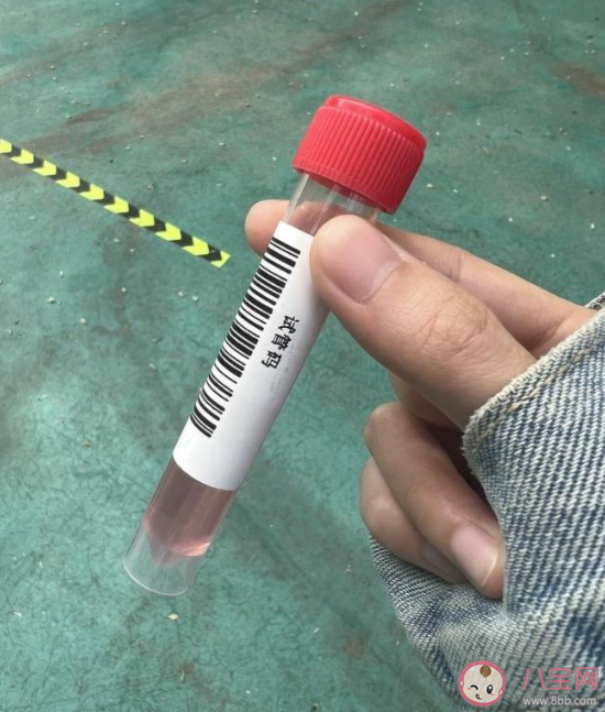 核酸檢測管里的紅色液體是什么 為什么是紅色的 核酸檢測管里的紅色液體是什么 為什么是紅色的