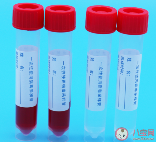 核酸檢測管里的紅色液體是什么 為什么是紅色的 核酸檢測管里的紅色液體是什么 為什么是紅色的
