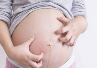 妊娠糖尿病和胖瘦有關系嗎 孕期血糖高怎樣控制