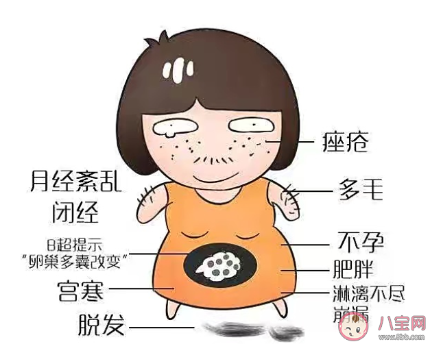 患有多囊卵巢能懷孕嗎 多囊卵巢的癥狀有哪些