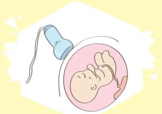 正常的胎心大概是多少 怎么做胎心監護才能一次性過