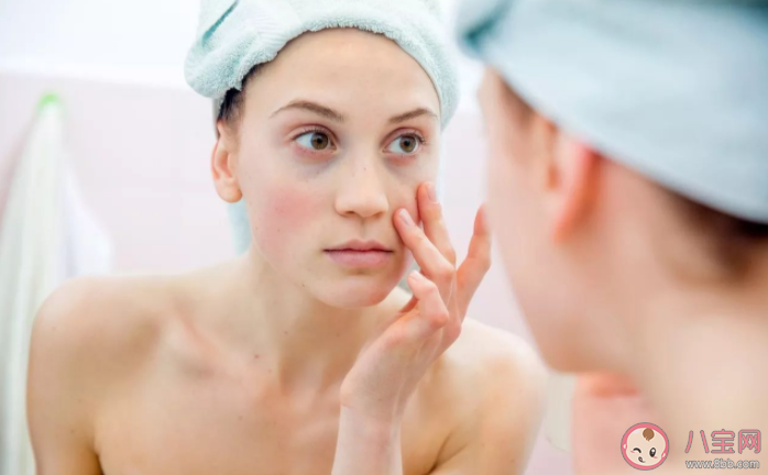 黑眼圈長期消不掉有哪些可能 不同類型黑眼圈怎么解決 黑眼圈長期消不掉有哪些可能 不同類型黑眼圈怎么解決