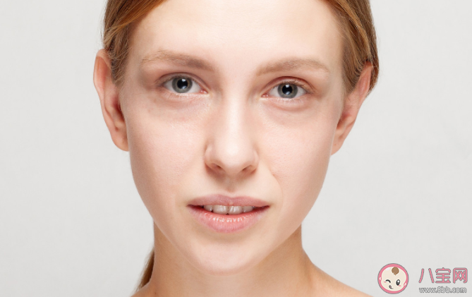 黑眼圈長期消不掉有哪些可能 不同類型黑眼圈怎么解決 黑眼圈長期消不掉有哪些可能 不同類型黑眼圈怎么解決