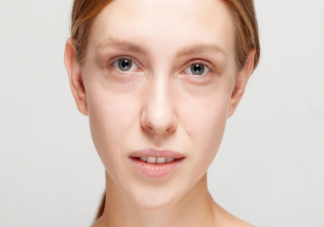 黑眼圈長期消不掉有哪些可能 不同類型黑眼圈怎么解決