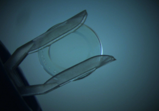 OK鏡會磨損角膜嗎 OK鏡為什么這么貴