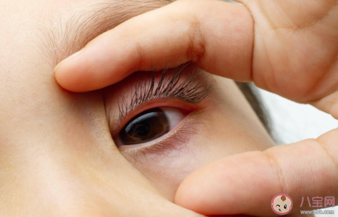 眼皮跳是要面癱了嗎 出現眼皮跳動怎么辦 眼皮跳是要面癱了嗎 出現眼皮跳動怎么辦