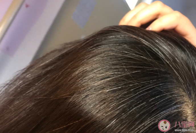 白發(fā)突然增多是缺什么營養(yǎng) 白發(fā)越來越多怎么辦 白發(fā)突然增多是缺什么營養(yǎng) 白發(fā)越來越多怎么辦