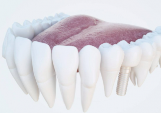 根管治療有多復雜 根管治療要花多少錢