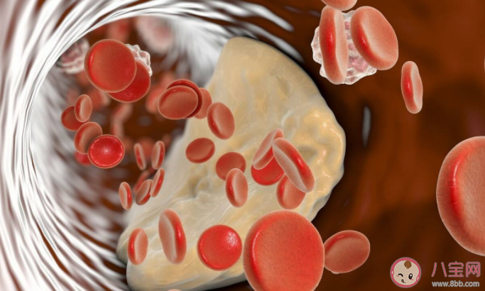 大腦供血不足有什么表現 哪些病因可能會引起腦供血不足