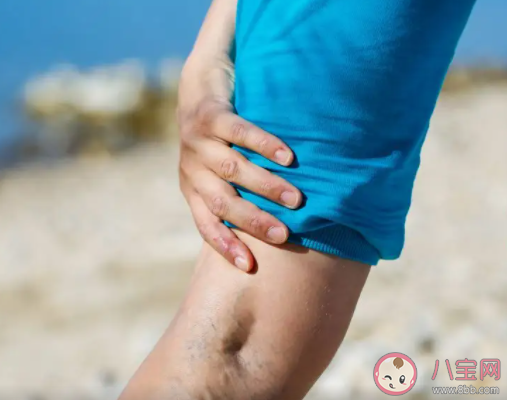 蹲的時間久了腿會麻通常是因為 螞蟻莊園7月17日答案最新 蹲的時間久了腿會麻通常是因為 螞蟻莊園7月17日答案最新