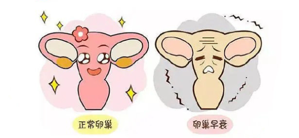 卵巢早衰的征兆有哪些 如何防止卵巢早衰 卵巢早衰的征兆有哪些 如何防止卵巢早衰