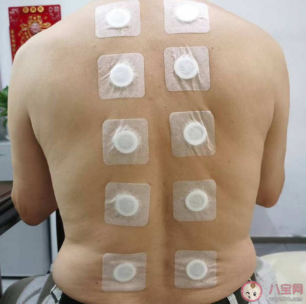 2022三伏貼多久貼一次 三伏貼怎么根據病癥貼穴位 2022三伏貼多久貼一次 三伏貼怎么根據病癥貼穴位