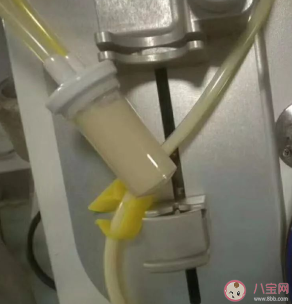 牛奶血是什么意思 牛奶血為什么不能給病人輸用