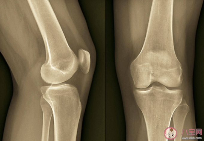 為什么爸媽一吹空調就覺得關節疼 吹空調出現關節疼怎么辦 為什么爸媽一吹空調就覺得關節疼 吹空調出現關節疼怎么辦