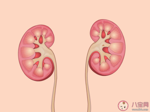 夏季為什么尿路結(jié)石高發(fā) 尿路結(jié)石如何預(yù)防