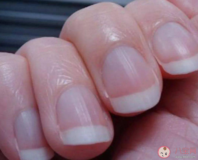 幾個(gè)月牙最健康 手指月牙突然多或少是身體有問題嗎 幾個(gè)月牙最健康 手指月牙突然多或少是身體有問題嗎