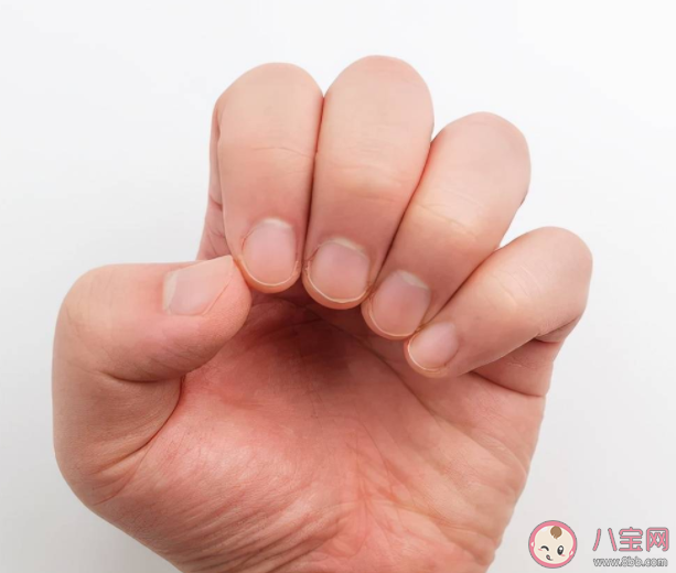 幾個(gè)月牙最健康 手指月牙突然多或少是身體有問題嗎 幾個(gè)月牙最健康 手指月牙突然多或少是身體有問題嗎