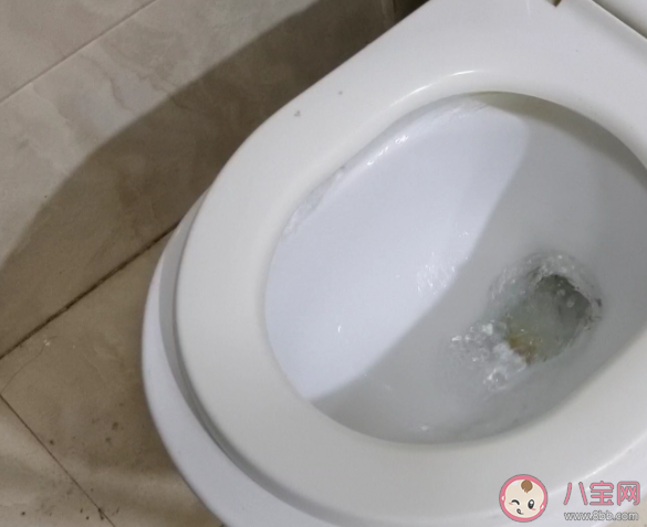 用衛(wèi)生紙不能直接沖馬桶 衛(wèi)生間垃圾桶好幾天不倒有什么影響 用衛(wèi)生紙不能直接沖馬桶 衛(wèi)生間垃圾桶好幾天不倒有什么影響