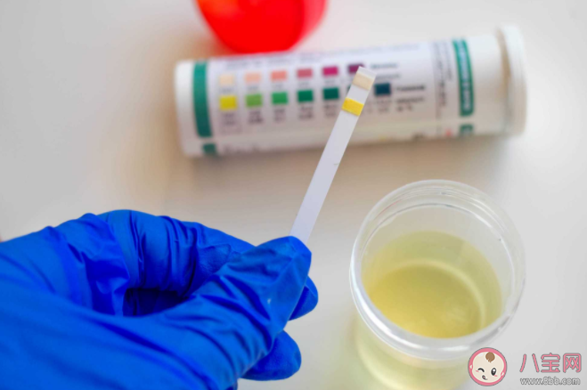 小便顏色深淺和上火有關(guān)系嗎 不同顏色尿液代表什么狀態(tài) 小便顏色深淺和上火有關(guān)系嗎 不同顏色尿液代表什么狀態(tài)